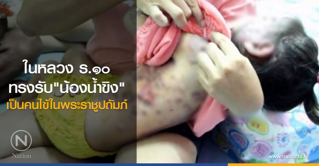 ในหลวง ร.๑๐ ทรงรับ "น้องน้ำขิง" เป็นคนไข้ในพระราชูปถัมภ์ ในหลวง ร.๑๐ ทรงรับ "น้องน้ำขิง" เป็นคนไข้ในพระราชูปถัมภ์