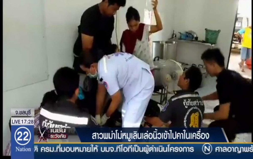 สาวพม่าโม่หมูพลาด นิ้วติดคาเครื่อง สาวพม่าโม่หมูพลาด นิ้วติดคาเครื่อง