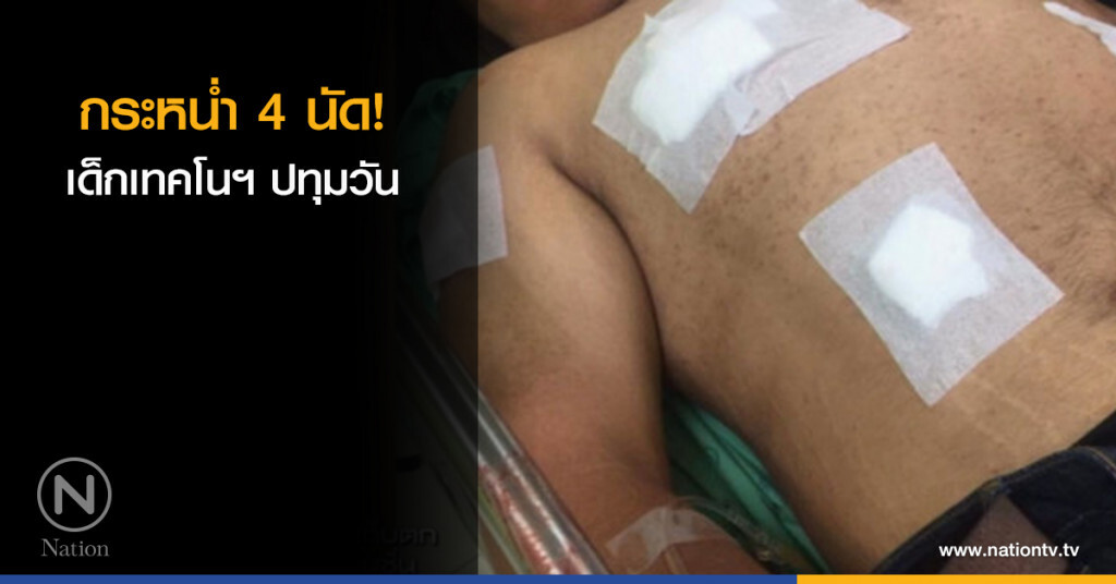 กระหน่ำ 4 นัด เด็กเทคโนฯ ปทุมวัน