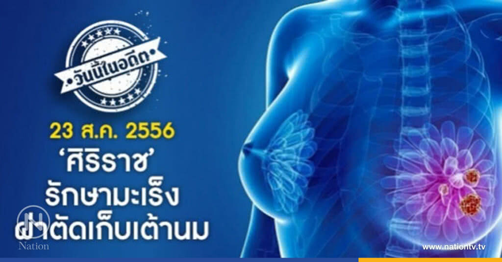 วันนี้ในอดีต 'ศิริราช' รักษามะเร็ง ผ่าตัดเก็บเต้านม วันนี้ในอดีต 'ศิริราช' รักษามะเร็ง ผ่าตัดเก็บเต้านม