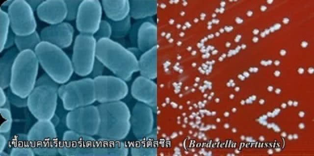 กรมวิทยาศาสตร์การแพทย์ เปิดบริการตรวจสารพันธุกรรม เชื้อก่อโรคไอกรนแห่งแรกในภาคใต้