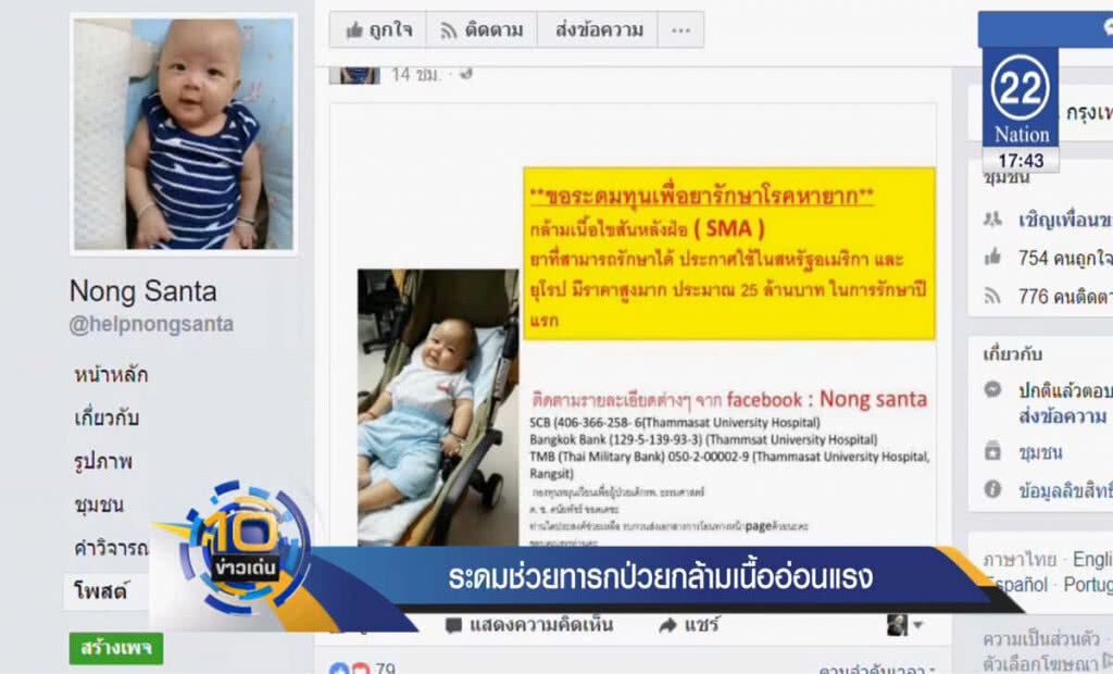 ระดมช่วยทารก ป่วยกล้ามเนื้ออ่อนแรง ระดมช่วยทารก ป่วยกล้ามเนื้ออ่อนแรง