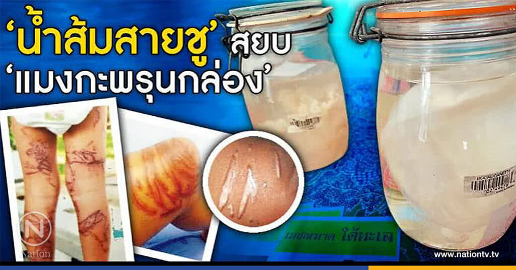 "แมงกะพรุนกล่อง"ที่ว่าร้ายยังต้องพ่าย "น้ำส้มสายชู" "แมงกะพรุนกล่อง"ที่ว่าร้ายยังต้องพ่าย "น้ำส้มสายชู"