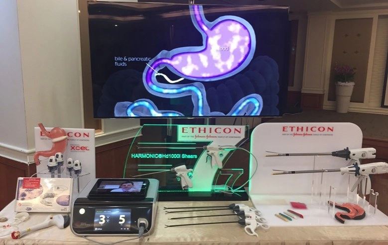 ผ่าตัดลดขนาดกระเพาะคนอ้วนห่างไกลโรค