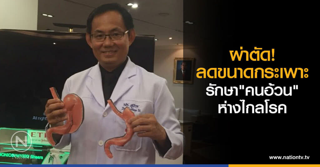 ผ่าตัดลดขนาดกระเพาะคนอ้วนห่างไกลโรค ผ่าตัดลดขนาดกระเพาะคนอ้วนห่างไกลโรค