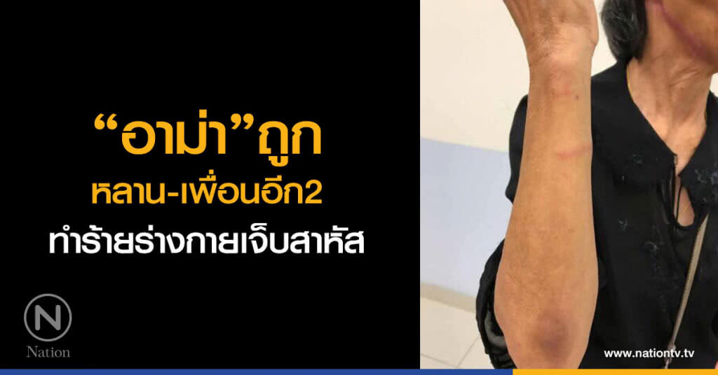 อาม่า ถูก
หลาน-เพื่อนอีก2
ทำร้ายร่างกายเจ็บสาหัส อาม่า ถูก
หลาน-เพื่อนอีก2
ทำร้ายร่างกายเจ็บสาหัส