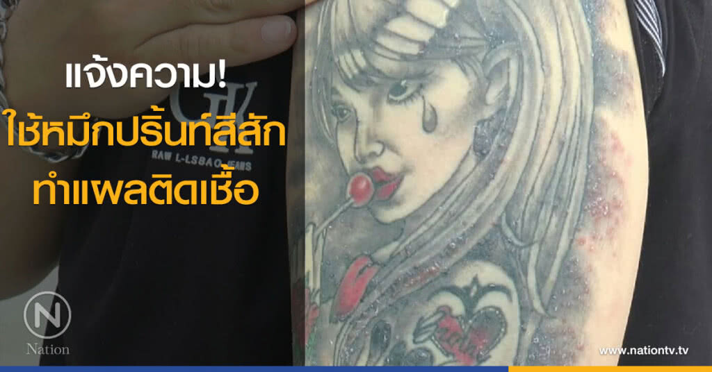 แจ้งความ! ใช้หมึกปริ้นท์สีสัก ทำแผลติดเชื้อ แจ้งความ! ใช้หมึกปริ้นท์สีสัก ทำแผลติดเชื้อ