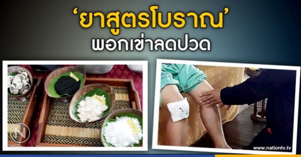 รพร.บ้านดุงใช้"ยาสูตรโบราณ"พอกเข่าลดปวดข้อเข่าเสื่อม รพร.บ้านดุงใช้"ยาสูตรโบราณ"พอกเข่าลดปวดข้อเข่าเสื่อม