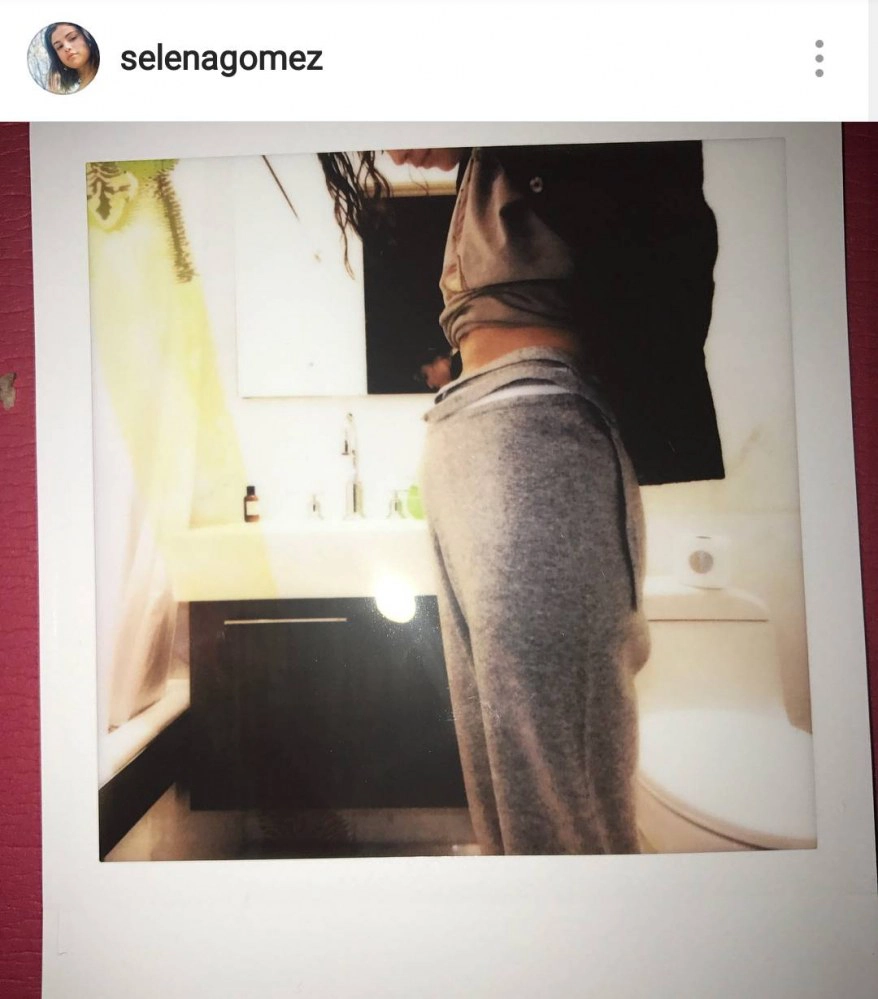 ช็อกแฟนคลับ! "เซเลน่า โกเมส" เปลี่ยนไต รักษาโรคพุ่มพวง