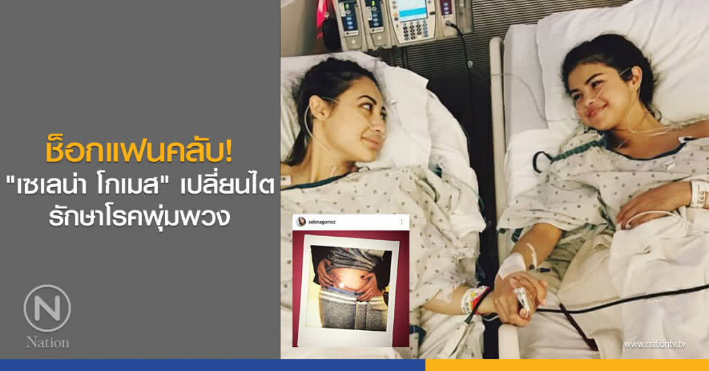 ช็อกแฟนคลับ! "เซเลน่า โกเมส" เปลี่ยนไต รักษาโรคพุ่มพวง ช็อกแฟนคลับ! "เซเลน่า โกเมส" เปลี่ยนไต รักษาโรคพุ่มพวง