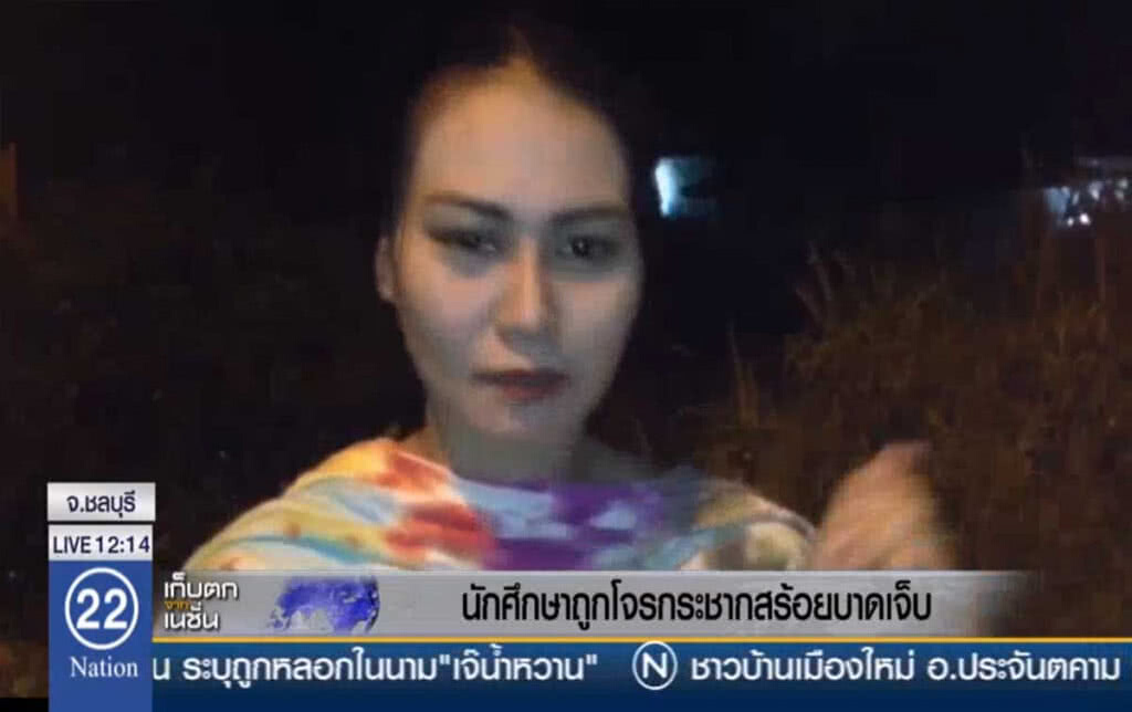 นักศึกษาถูกโจรกระชากสร้อยบาดเจ็บ นักศึกษาถูกโจรกระชากสร้อยบาดเจ็บ