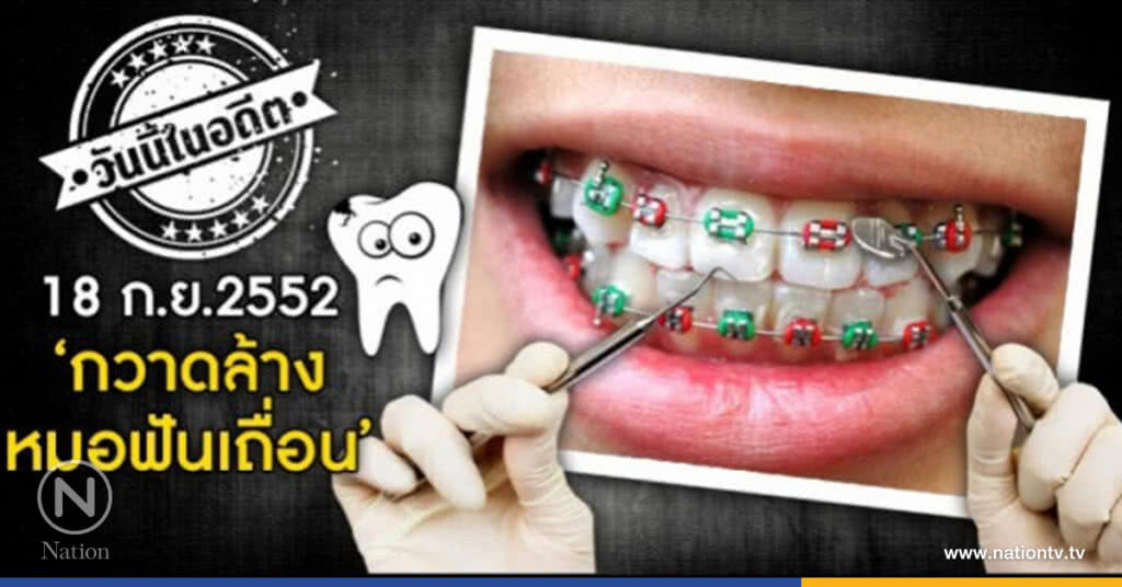 วันนี้ในอดีต : กวาดล้าง "หมอฟัน" เถื่อน! วันนี้ในอดีต : กวาดล้าง "หมอฟัน" เถื่อน!