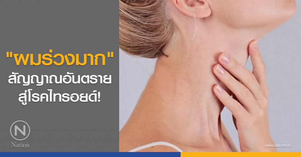 "ผมร่วงมาก" สัญญาณอันตราย สู่โรคไทรอยด์!