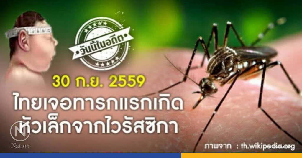 วันนี้ในอดีต 30 ก.ย.59"ไทยเจอทารกแรกเกิดหัวเล็กจากไวรัสซิกา" วันนี้ในอดีต 30 ก.ย.59"ไทยเจอทารกแรกเกิดหัวเล็กจากไวรัสซิกา"