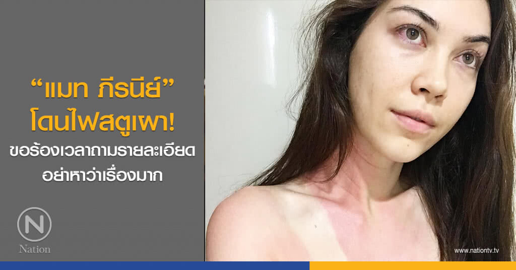 "แมท ภีรนีย์" โดนไฟสตูเผา! ขอร้องเวลาถามรายละเอียด อย่าหาว่าเรื่องมาก