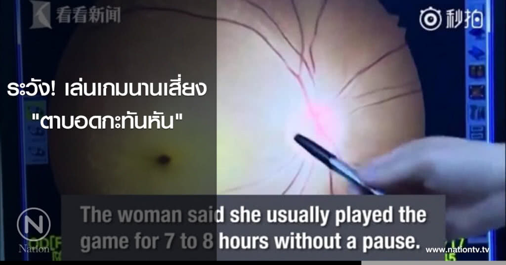 ระวัง! เล่นเกมนานเสี่ยง‘ตาบอดกะทันหัน’ ระวัง! เล่นเกมนานเสี่ยง‘ตาบอดกะทันหัน’