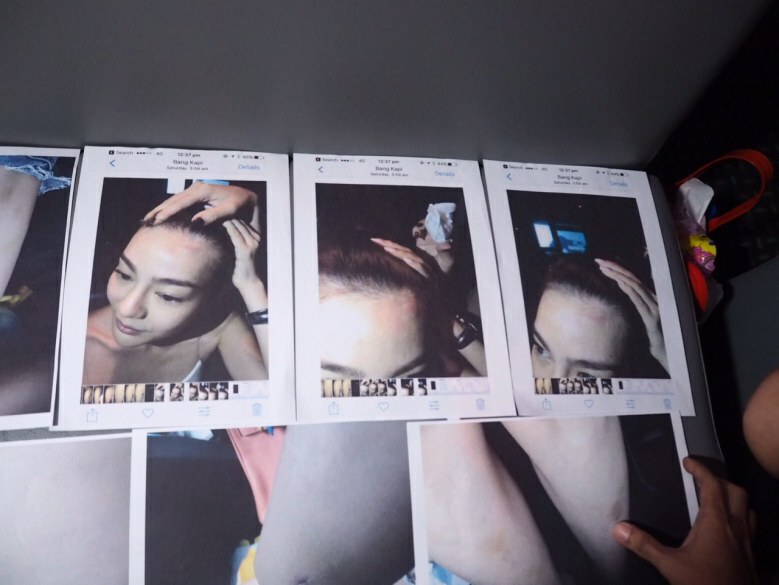 "ดิว" เคลียร์ข่าว
 นางร้าย ด. 
ตบลูก ส.ส. กลางผับ
ยันตัวเองเป็นฝ่ายถูกทำร้าย
แถมโดนข่มขู่