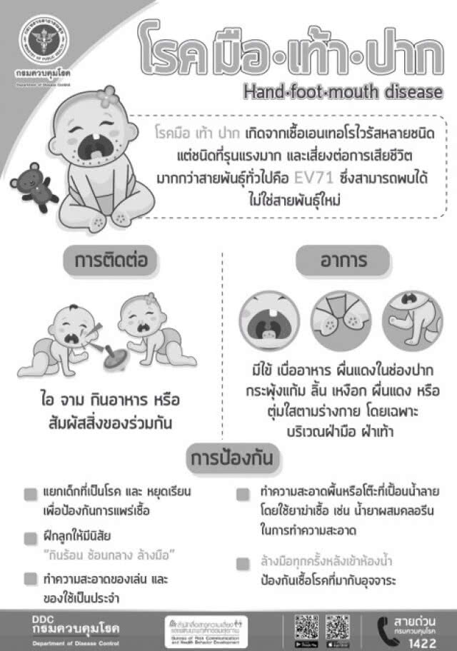 แนะผู้ปกครองดูแลบุตรหลาน
พบเด็กป่วยโรคมือ เท้า ปาก เพิ่ม
มีไข้ ตุ่มน้ำใส/เม็ดแดงๆ รีบพบแพทย์