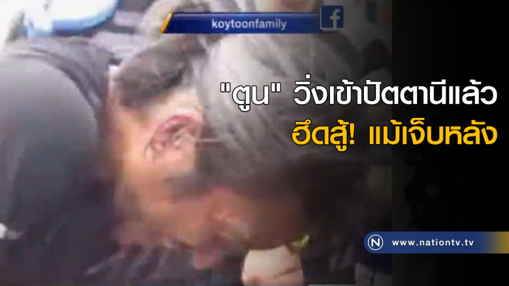 "ตูน" วิ่งเข้าปัตตานีแล้ว ฮึดสู้! แม้เจ็บหลัง