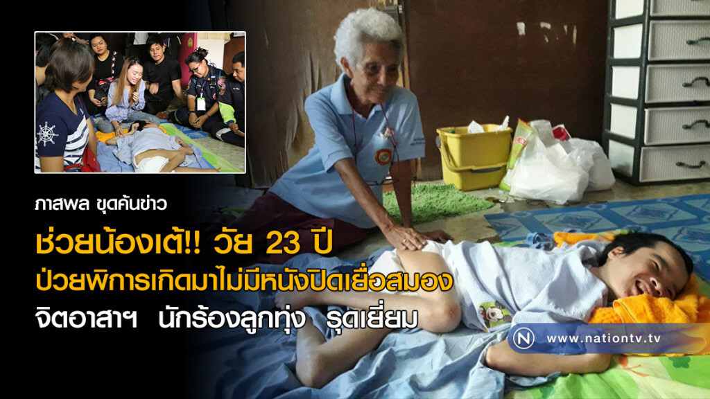 ช่วยน้องเต้!! วัย 23 ปี 
ป่วยพิการเกิดมาไม่มีหนังปิดเยื่อสมอง
จิตอาสาฯ  นักร้องลูกทุ่ง  รุดเยี่ยม