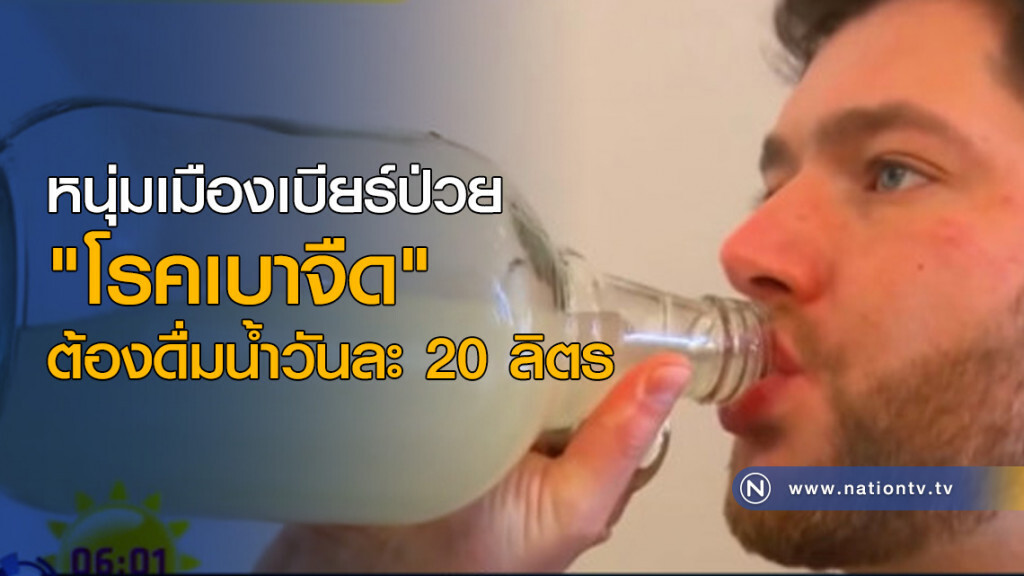 หนุ่มเมืองเบียร์ป่วย "โรคเบาจืด" ต้องดื่มน้ำวันละ 20 ลิตร หนุ่มเมืองเบียร์ป่วย "โรคเบาจืด" ต้องดื่มน้ำวันละ 20 ลิตร
