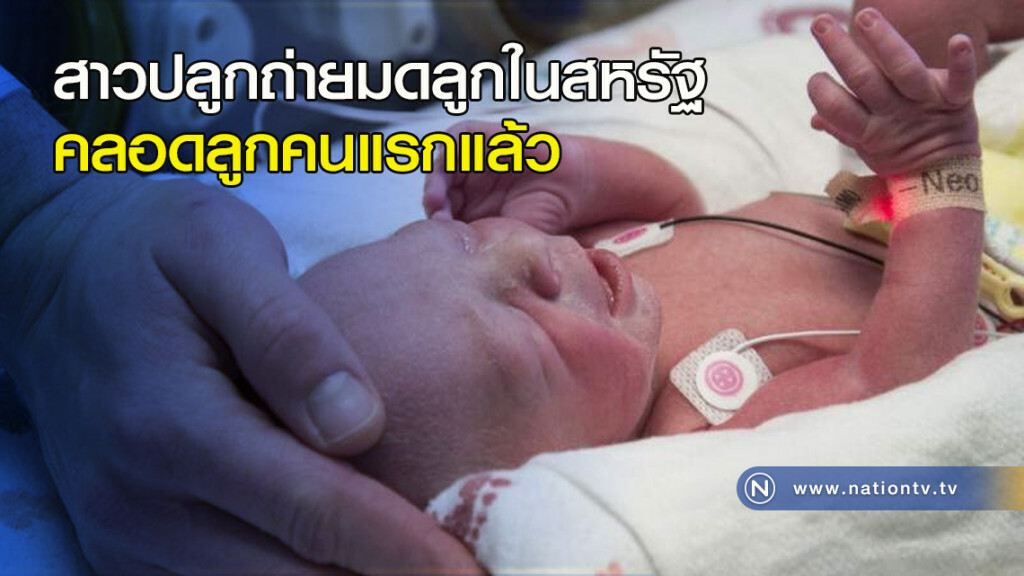สาวปลูกถ่ายมดลูกในสหรัฐ คลอดลูกคนแรกแล้ว