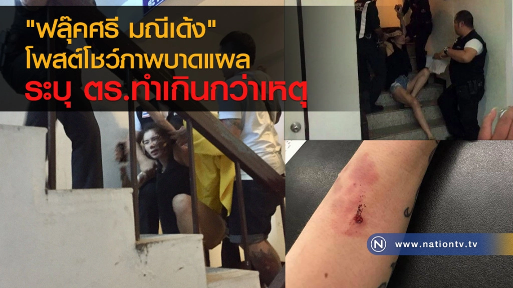 "ฟลุ๊คศรี มณีเด้ง"
โพสต์เฟซบุ๊กโชว์ภาพบาดแผล
ระบุ ตร.ทำเกินกว่าเหตุ