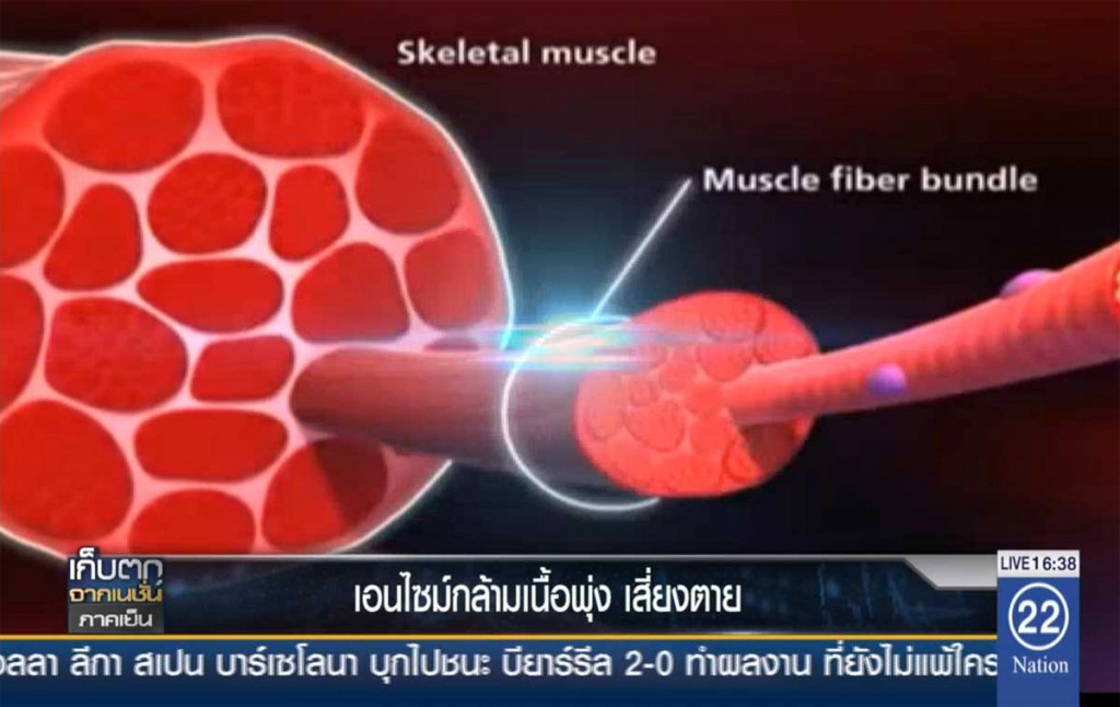 เอนไซม์กล้ามเนื้อพุ่ง เสี่ยงตาย