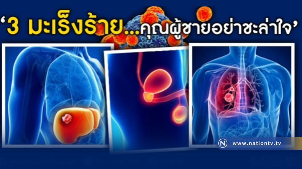 ผู้ชายฟังทางนี้! อย่าชะล่าใจ..."3 มะเร็งร้าย" ที่ควรระวัง
