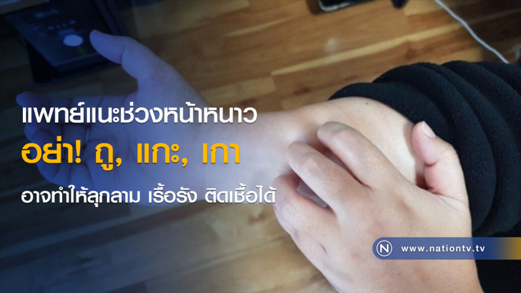 แพทย์แนะช่วงหน้าหนาว อย่า! ถู, แกะ, เกา อาจทำให้ลุกลาม เรื้อรัง ติดเชื้อได้