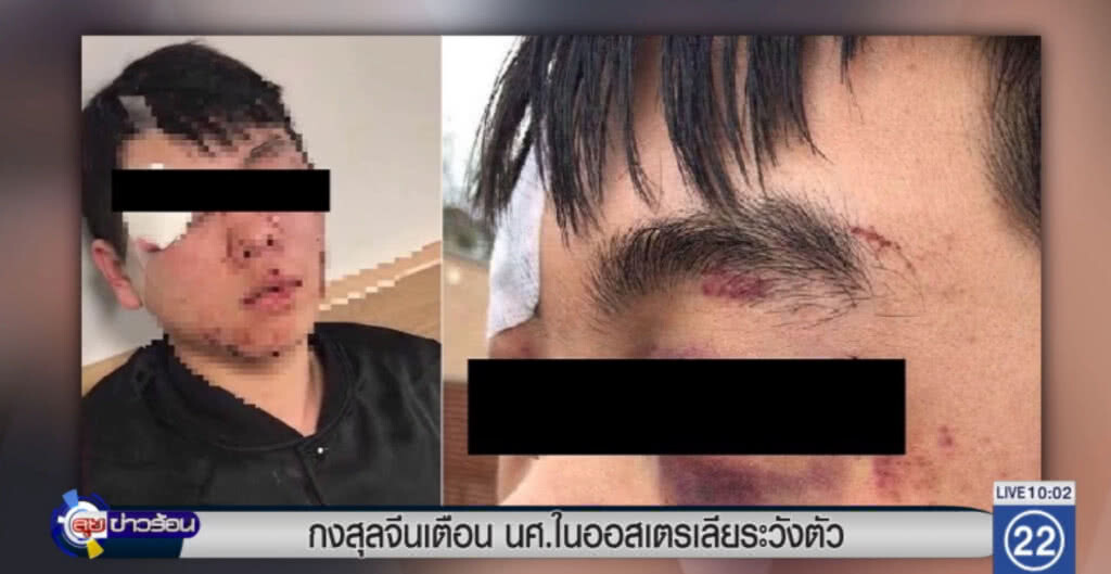 สถานกงสุลจีนในออสเตรเลีย เตือนน.ศ.ให้ระวังตัว หลังมีคดีทำร้ายน.ศ.จีนต่อเนื่อง สถานกงสุลจีนในออสเตรเลีย เตือนน.ศ.ให้ระวังตัว หลังมีคดีทำร้ายน.ศ.จีนต่อเนื่อง