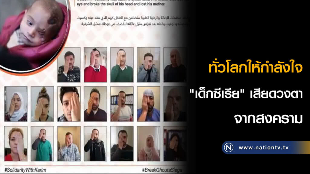 ทั่วโลกให้กำลังใจ "เด็กซีเรีย" เสียดวงตาจากสงคราม
