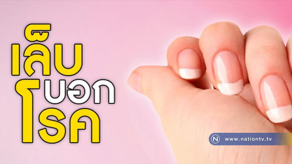 กรมการแพทย์ชี้ "เล็บ" ส่งสัญญาณบอกโรค กรมการแพทย์ชี้ "เล็บ" ส่งสัญญาณบอกโรค