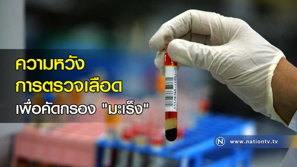 ความหวังของการตรวจเลือดเพื่อคัดกรอง "มะเร็ง" ความหวังของการตรวจเลือดเพื่อคัดกรอง "มะเร็ง"