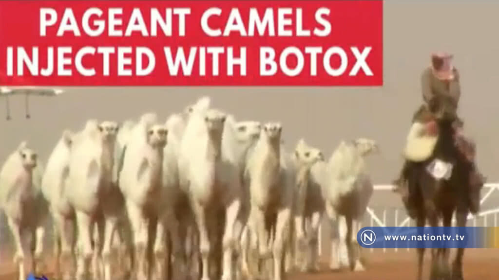 ปลด "อูฐซาอุฯ" หลังพบฉีด "โบท็อกซ์"