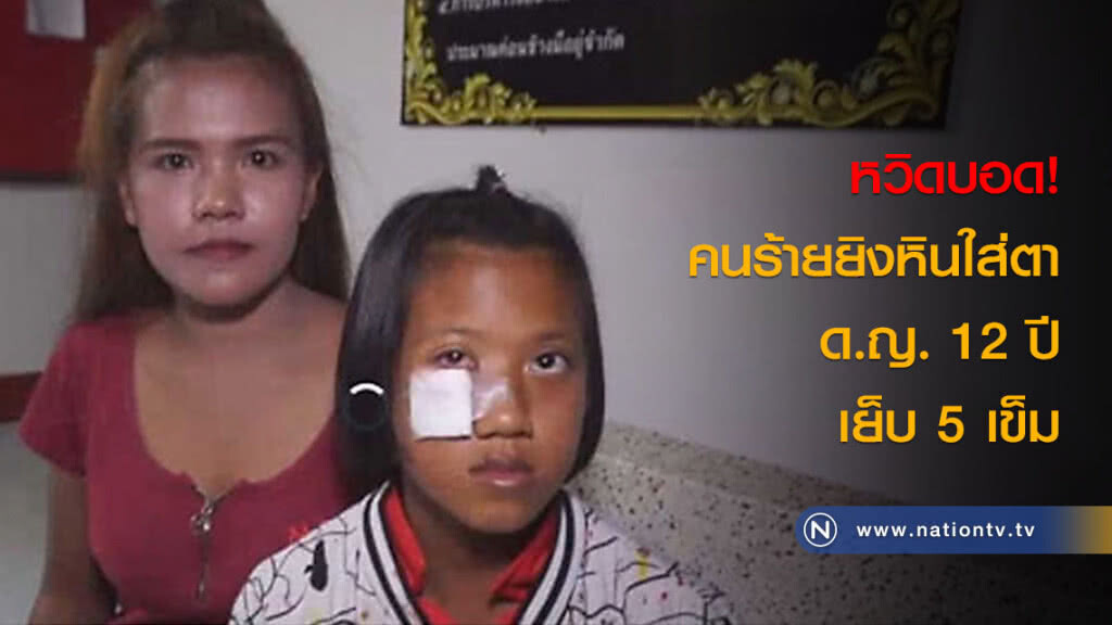 หวิดบอด! คนร้ายยิงหินใส่ตา ด.ญ. 12 ปีเย็บ 5 เข็ม หวิดบอด! คนร้ายยิงหินใส่ตา ด.ญ. 12 ปีเย็บ 5 เข็ม