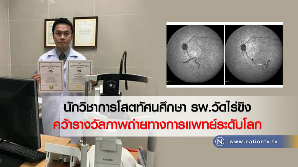นักวิชาการโสตทัศนศึกษา รพ.วัดไร่ขิง
คว้ารางวัลภาพถ่ายทางการแพทย์ระดับโลก