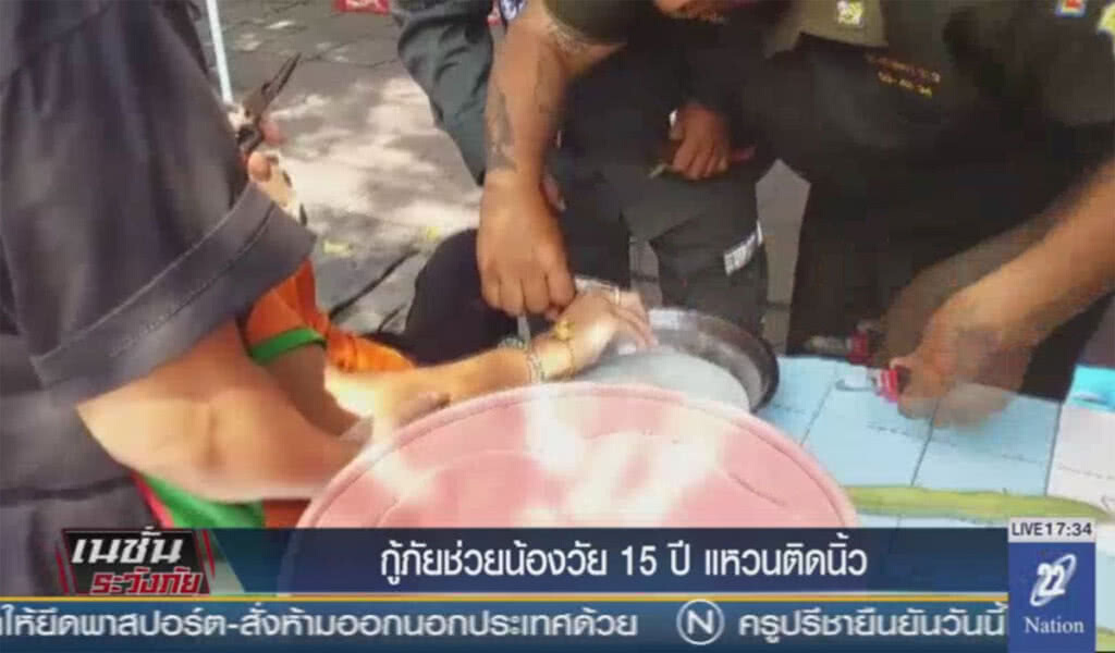 กู้ภัยฯช่วยน้องวัย 15 ปี แหวนติดนิ้ว กู้ภัยฯช่วยน้องวัย 15 ปี แหวนติดนิ้ว
