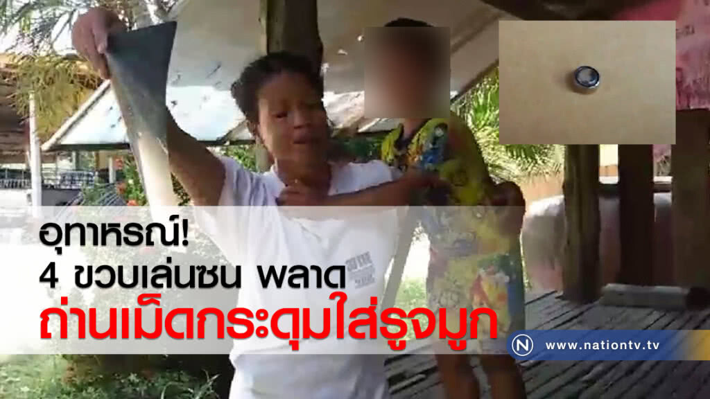 อุทาหรณ์! 4 ขวบเล่นซน ถ่านเม็ดกระดุมใส่รูจมูก อุทาหรณ์! 4 ขวบเล่นซน ถ่านเม็ดกระดุมใส่รูจมูก