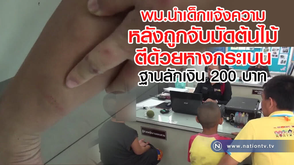 พม.นำเด็กแจ้งความ
หลังถูกจับมัดต้นไม้
ตีด้วยหางกระเบน
ฐานลักเงิน 200 บาท
เด็กรับผิดจริง