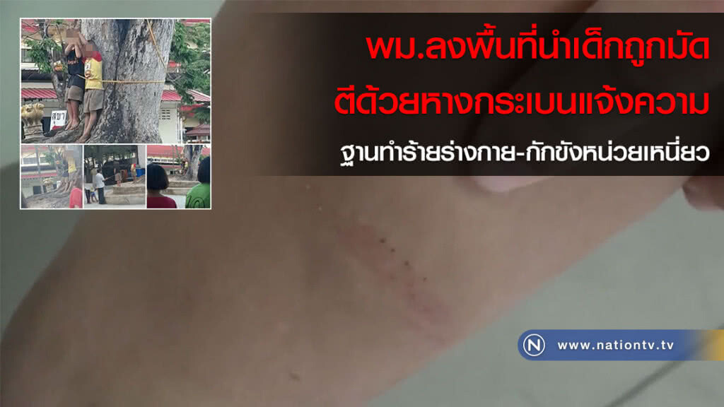 พม.ลงพื้นที่นำเด็กถูกมัดตีด้วยหางกระเบนแจ้งความ ฐานทำร้ายร่างกาย-กักขังหน่วยเหนี่ยว