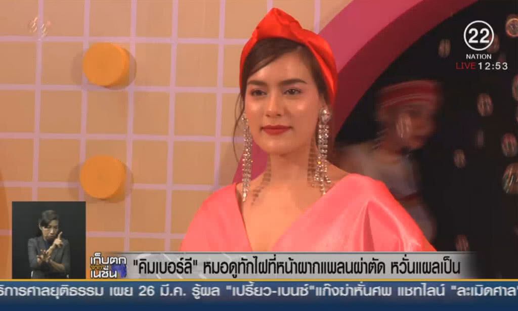"คิมเบอร์ลี"หมอดูทักไฝที่หน้าผาก เจ้าตัวแพลนผ่าตัด หวั่นแผลเป็น "คิมเบอร์ลี"หมอดูทักไฝที่หน้าผาก เจ้าตัวแพลนผ่าตัด หวั่นแผลเป็น