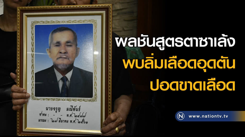 ผลชันสูตรตาซาเล้ง พบลิ่มเลือดอุดตัน-ปอดขาดเลือด ผลชันสูตรตาซาเล้ง พบลิ่มเลือดอุดตัน-ปอดขาดเลือด
