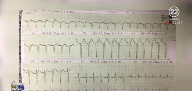เก็บตัวอย่างแมลงมรณะ หลัง 9 คนงาน จับกินแกล้มเหล้าจนเสียชีวิต