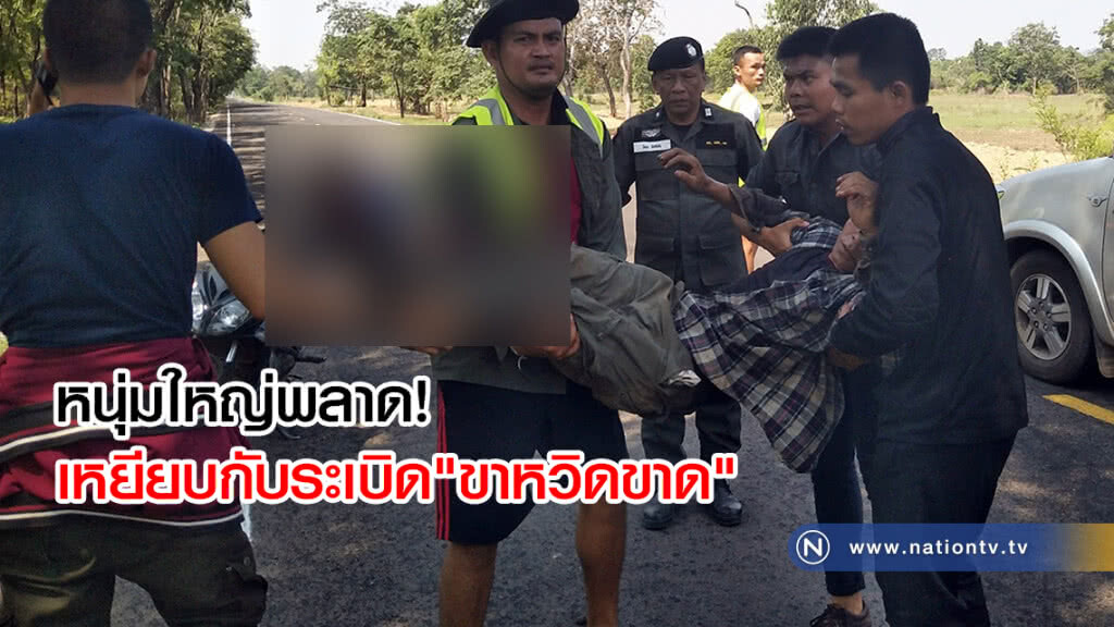 หนุ่มใหญ่พลาด
เหยียบกับระเบิด"ขาหวิดขาด"