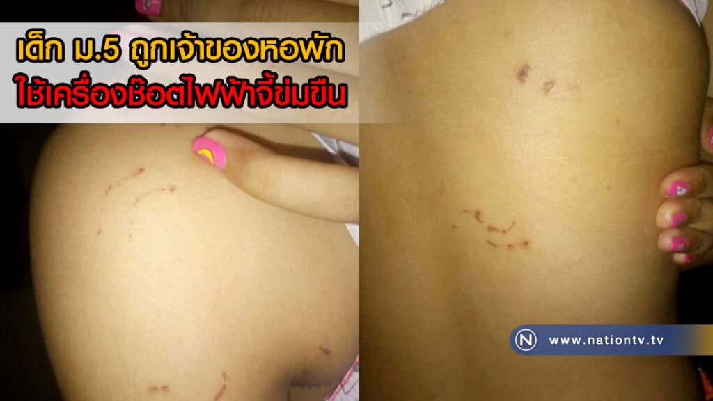 พ่อแม่สุดช้ำ! ลูกสาว ม.5 ถูกเจ้าของหอพักใช้เครื่องช๊อตไฟฟ้าจี้ข่มขืน จนสภาพจิตย่ำแย่(ภาพ)