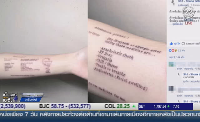 (คลิปข่าว) สาวเชียงใหม่ สักรายชื่อยาที่แพ้ พร้อมอาการ