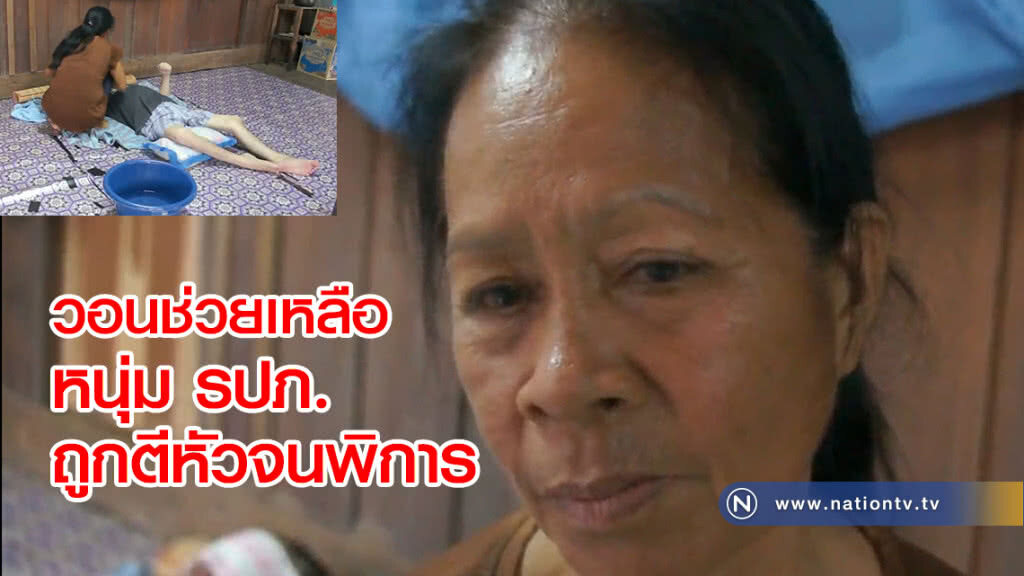 วอนช่วยเหลือ
หนุ่ม รปภ.ถูกคนร้ายตีหัวจนพิการ