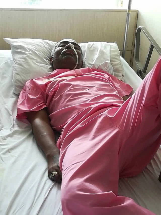 แพทย์แถลง"โจ้อี้ บาซู"สมองซีกซ้ายตาย อาการคงที่