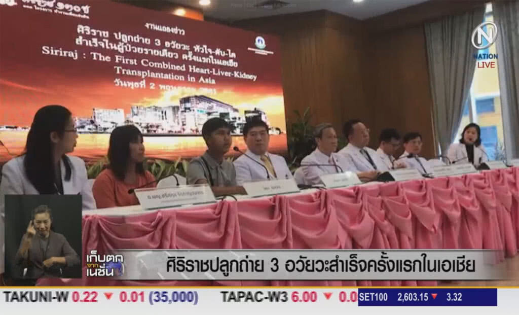(คลิปข่าว) ครั้งแรกในเอเชีย ศิริราชปลูกถ่าย 3 อวัยวะให้ผู้ป่วยรายเดียวสำเร็จ (คลิปข่าว) ครั้งแรกในเอเชีย ศิริราชปลูกถ่าย 3 อวัยวะให้ผู้ป่วยรายเดียวสำเร็จ
